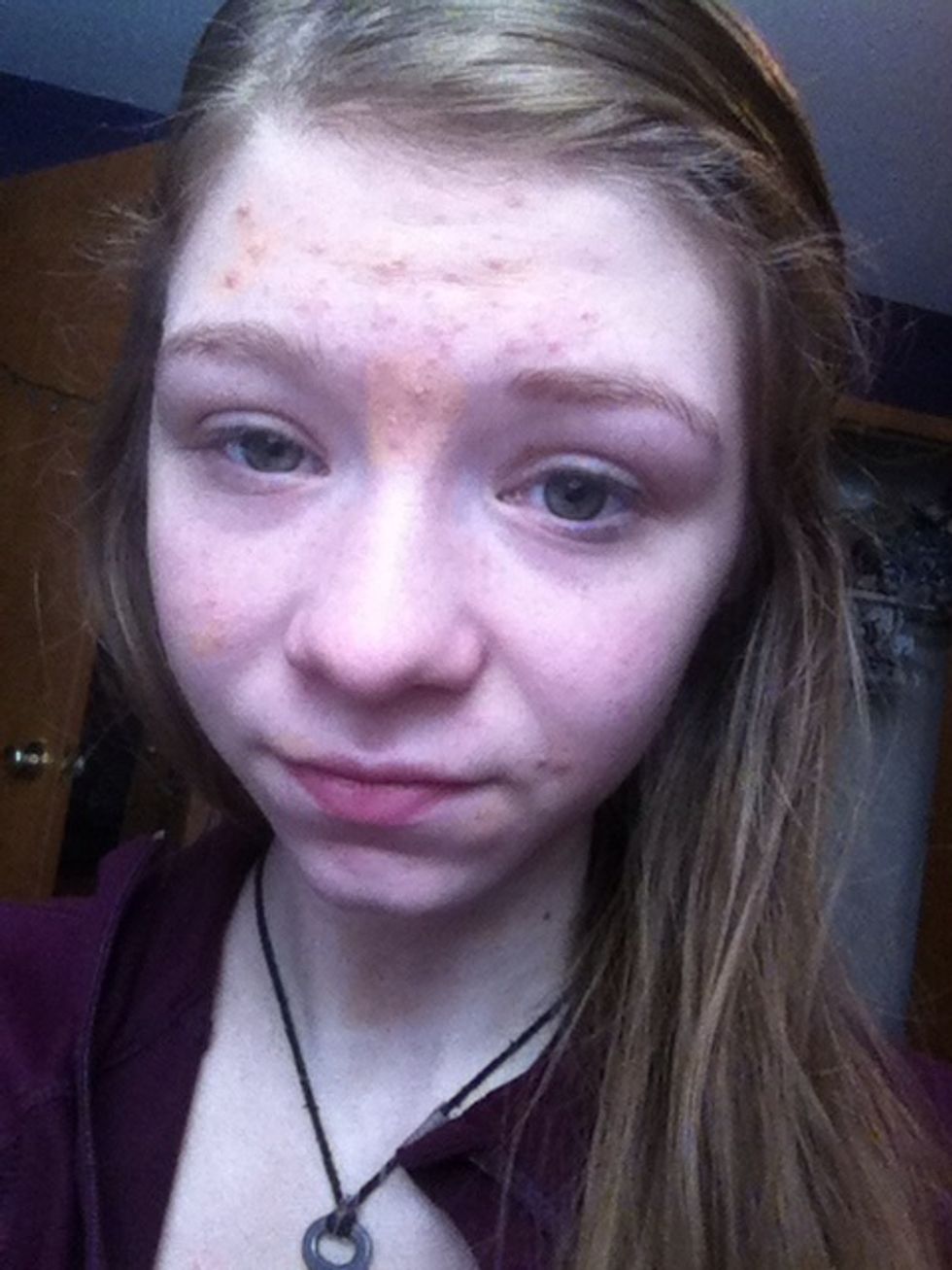 It doesn't have to be perfect, just apply it to reduce redness(: