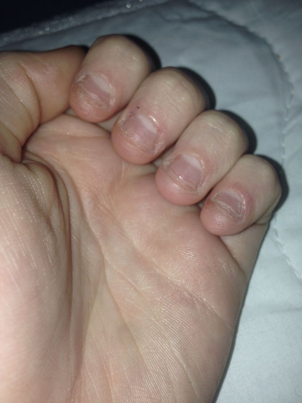 It's gotten really bad guys.... I wanna take scissors and slice off the nails now... I've done that before. But I won't. Gonna try again