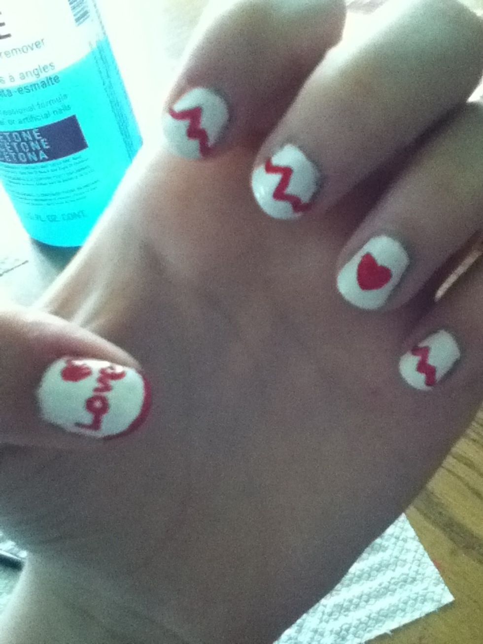 Just clean the spots around the nail