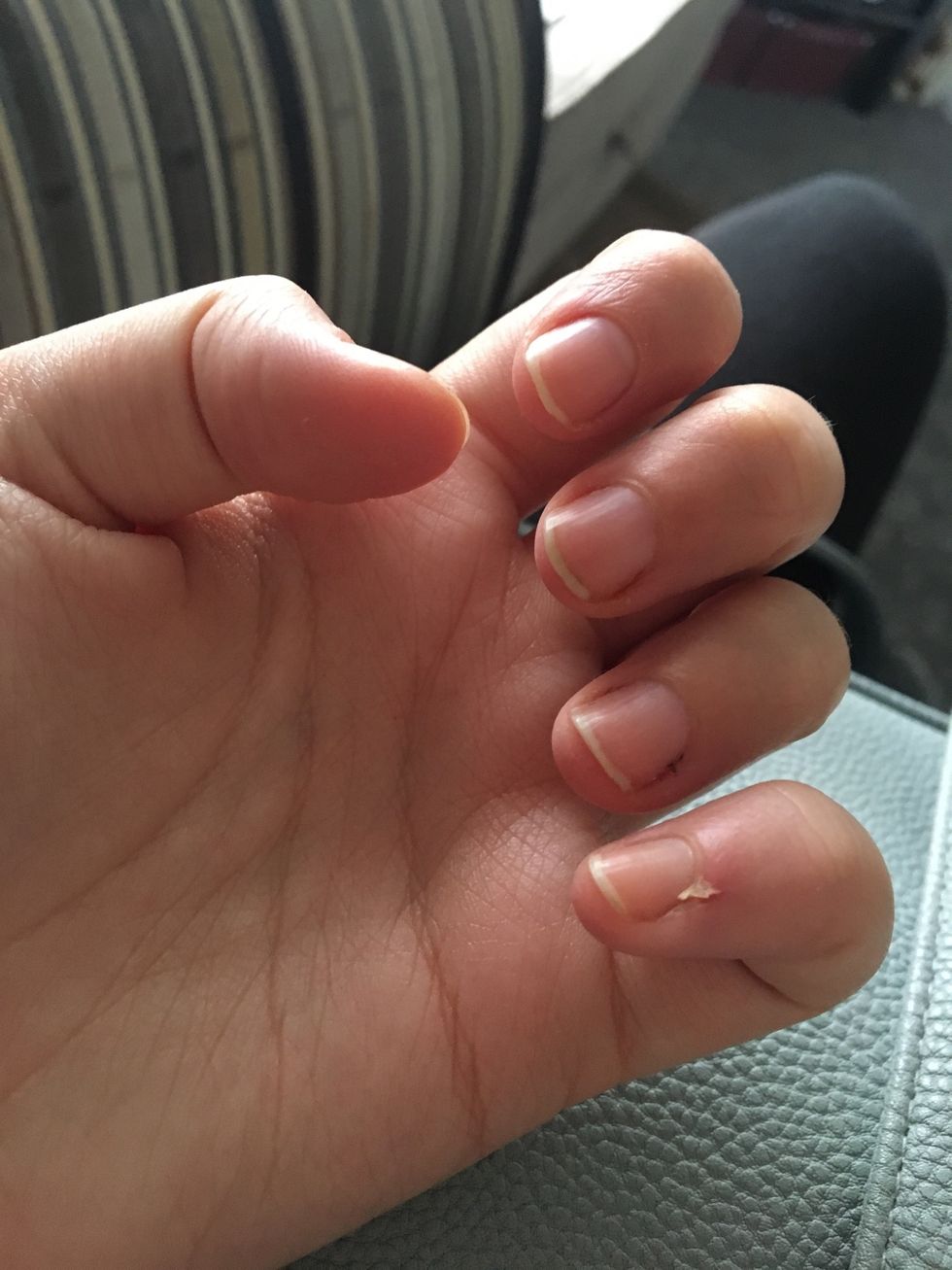 Just taken the nail polish off