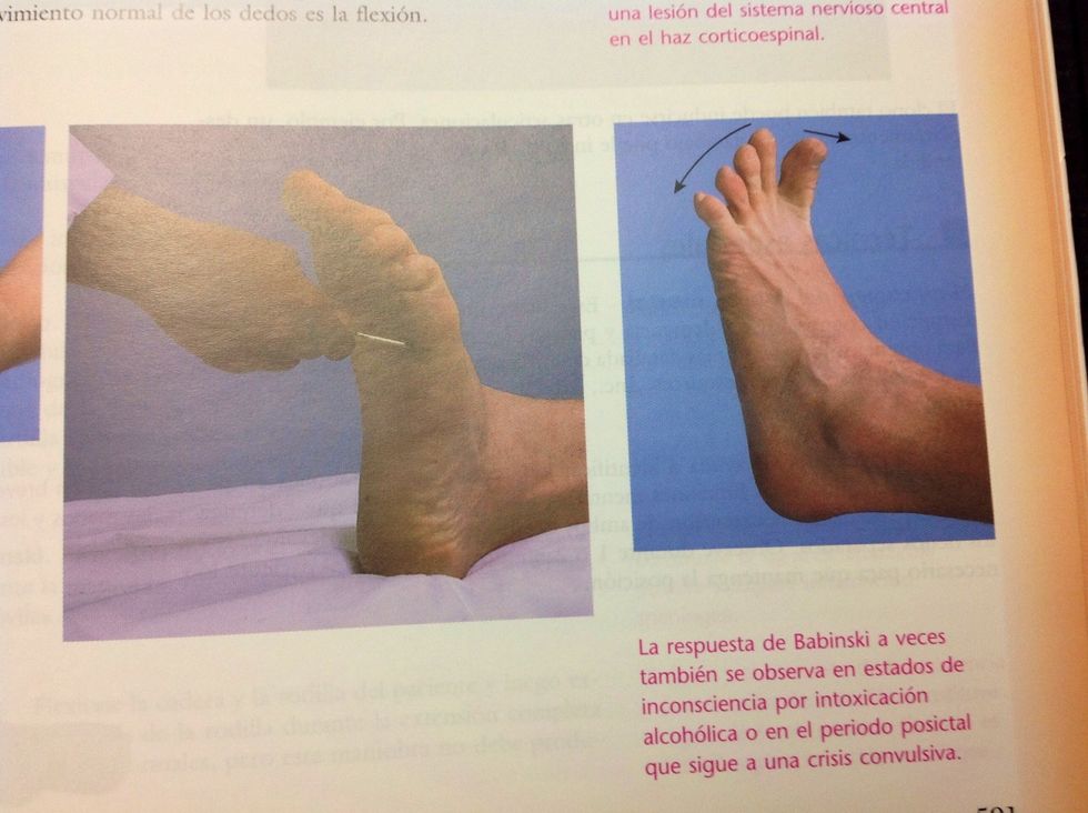 La respuesta plantar nos sirve para revisar l5 y s1 . La planta del pie se debe frotar con cualquier objeto y los dedos del pie se deben flexionar.