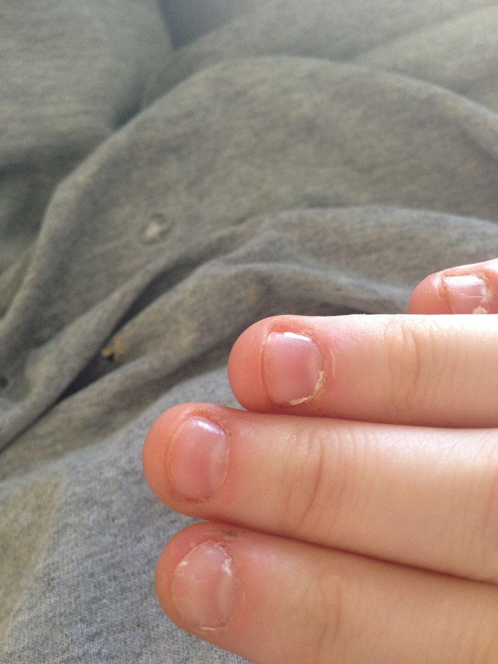 Look everyone! My nails are growing!!:) haven't bitten them, and my cuticles aren't growing back ;) in my case, I don't need to trim, but this is just to show you what to do if you don't know
