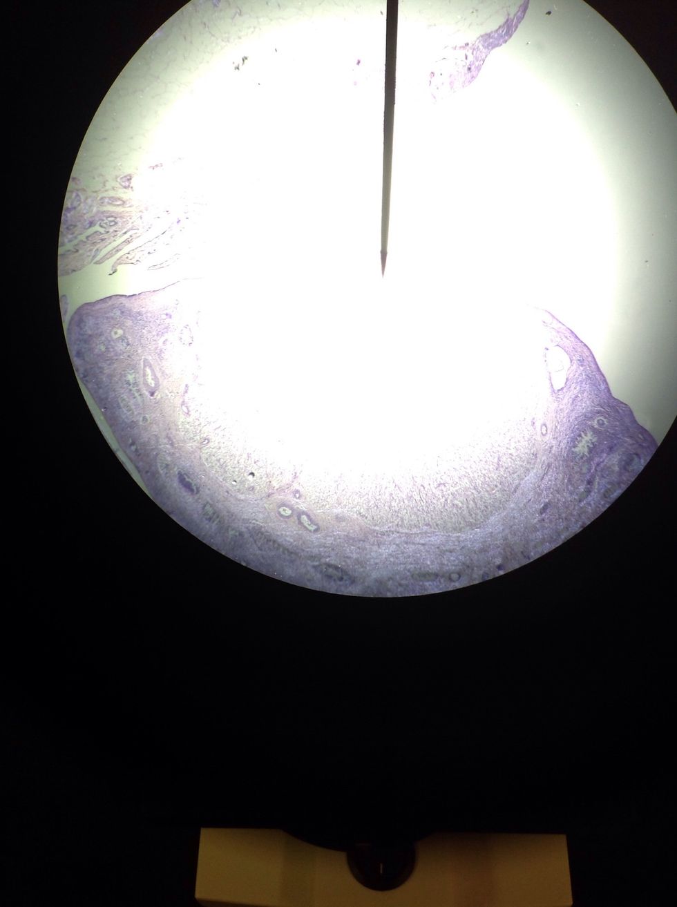 Look through microscope and line up tissue with arrow that is inside the lense. This increases the chance of finding a good picture when you zoom in.