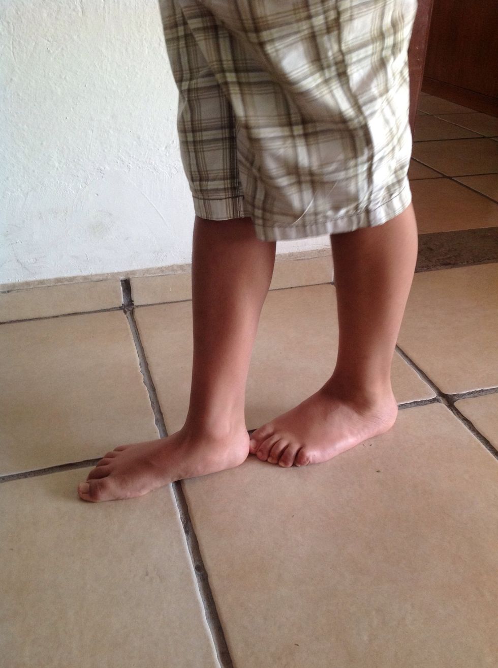 Marcha Pida al paciente que camine por la habitaci\u00f3n. Observe la postura, equilibrio, balanceo de manos y movimiento de las piernas. la marcha en t\u00e1ndem (en l\u00ednea recta), de puntillas y de talones.