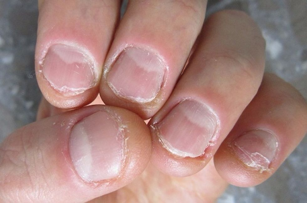 Not long ago, maybe 3 months, I was a severe nail biter. My nails looked like this. But then I tried what I'm about to tell you, and my nails now look like...