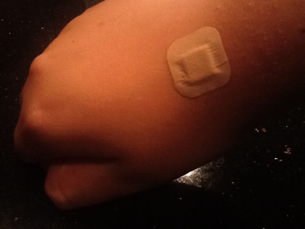 Now put any type of bandage on the bite to keep you from scratching the bite open and turning it into a scab. You may skip this step if you have amazing self control.