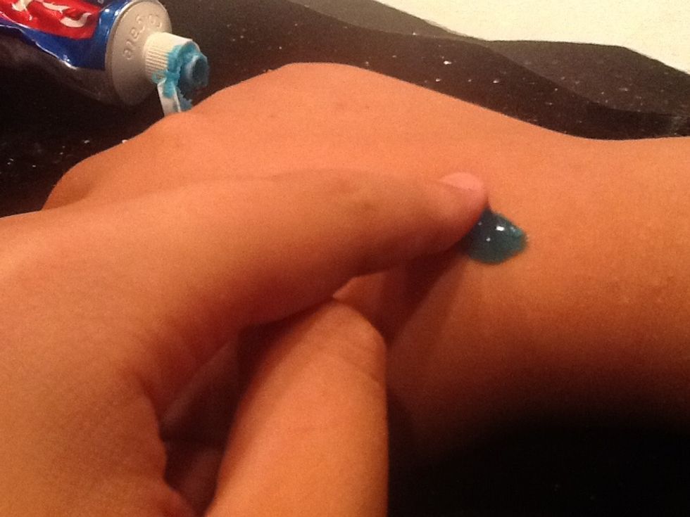 Now take your household tube of toothpaste and put a dab on your finger. Now rub the toothpaste on the bite to take away the itch from the bite.