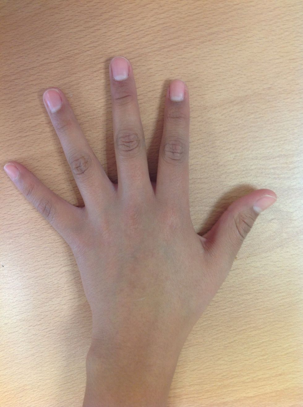 Observe la masa muscular identificando atrofia, principalmente los m\u00fasculos interesados de las manos.