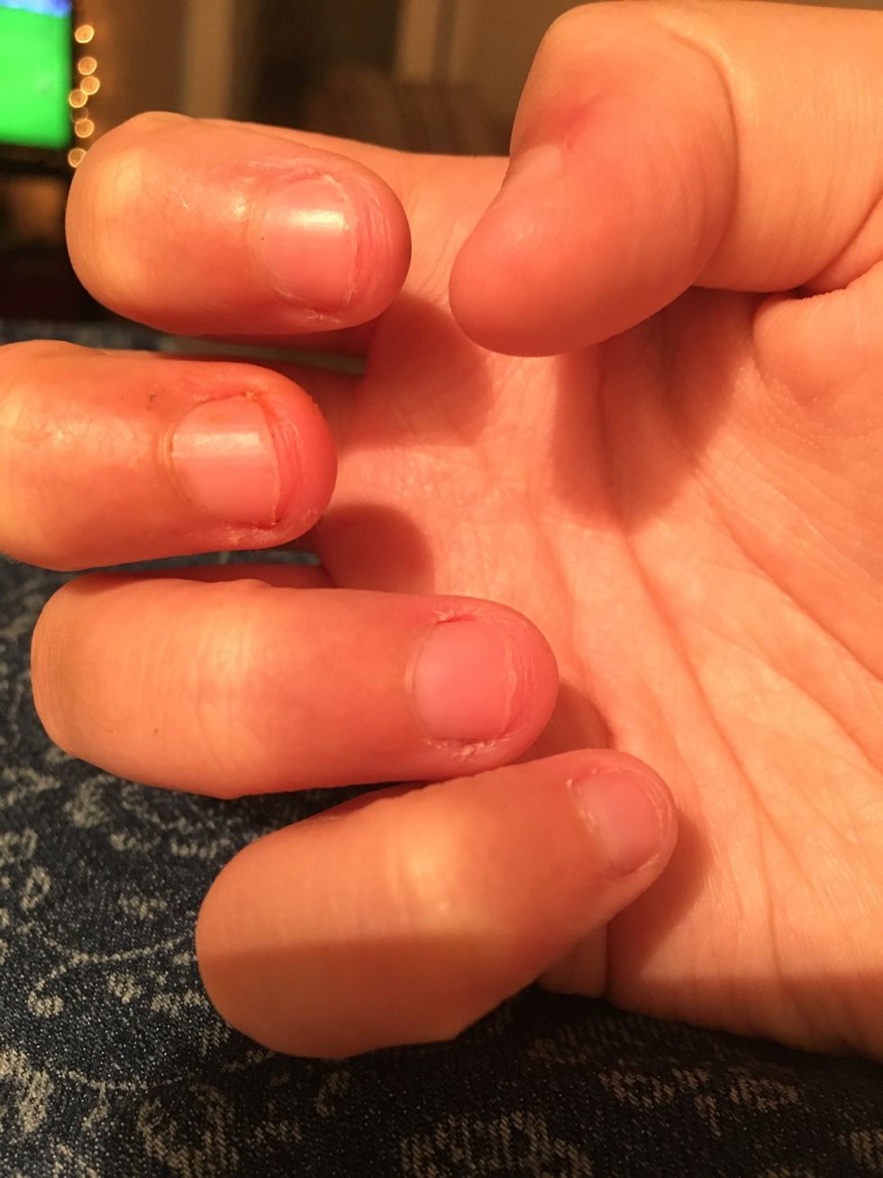 Ok, I bit my nails. A lot. I'm applying the growth polish still and am trying my best not to bite them anymore. Remember, they will grow back and it is completely normal to bite them again.