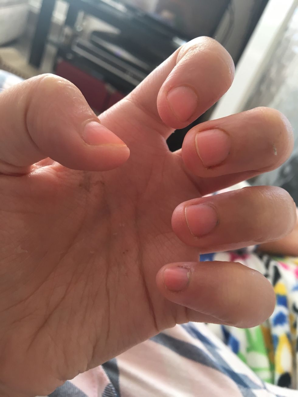 Ok, it's been about 5 days since I last uploaded and my nails are already much better. I have kept applying the growth formula and pushing back my cuticles twice a day. I can paint them now as well