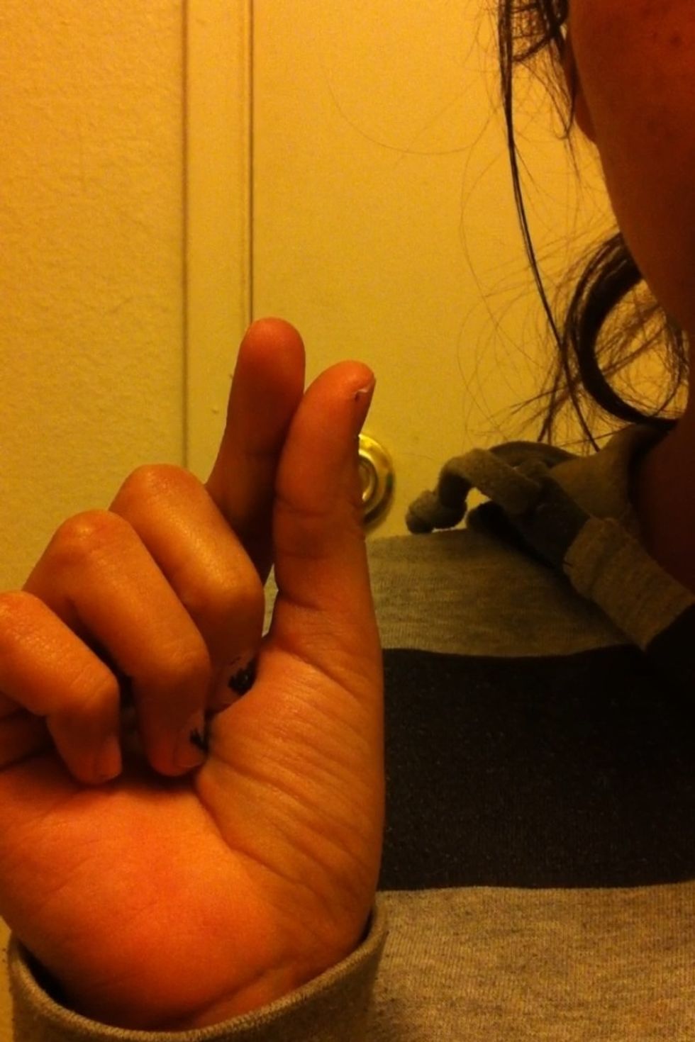 Once you get over the fear of touching your eyeball, use your two fingers to pinch out the contact CAREFULLY