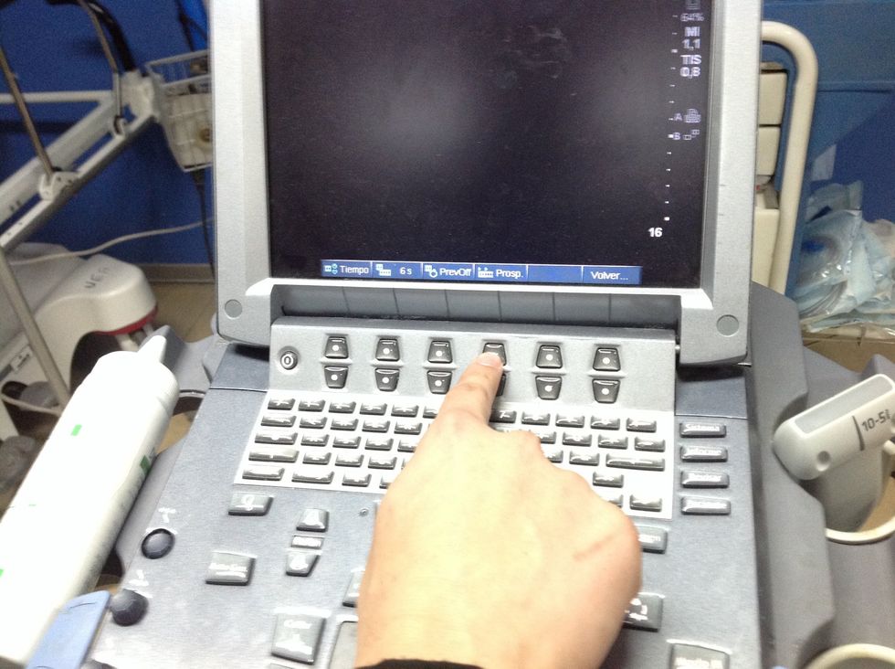 Opciones: Prospectivo, graba hacia adelante tras apretar bot\u00f3n "Clip"