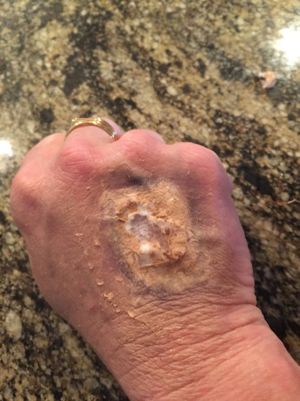 Open up the toilet paper.