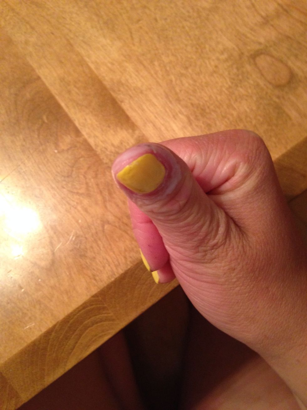 paint the glue on around your finger nail getting as close to the critical as possible without getting it on the nail