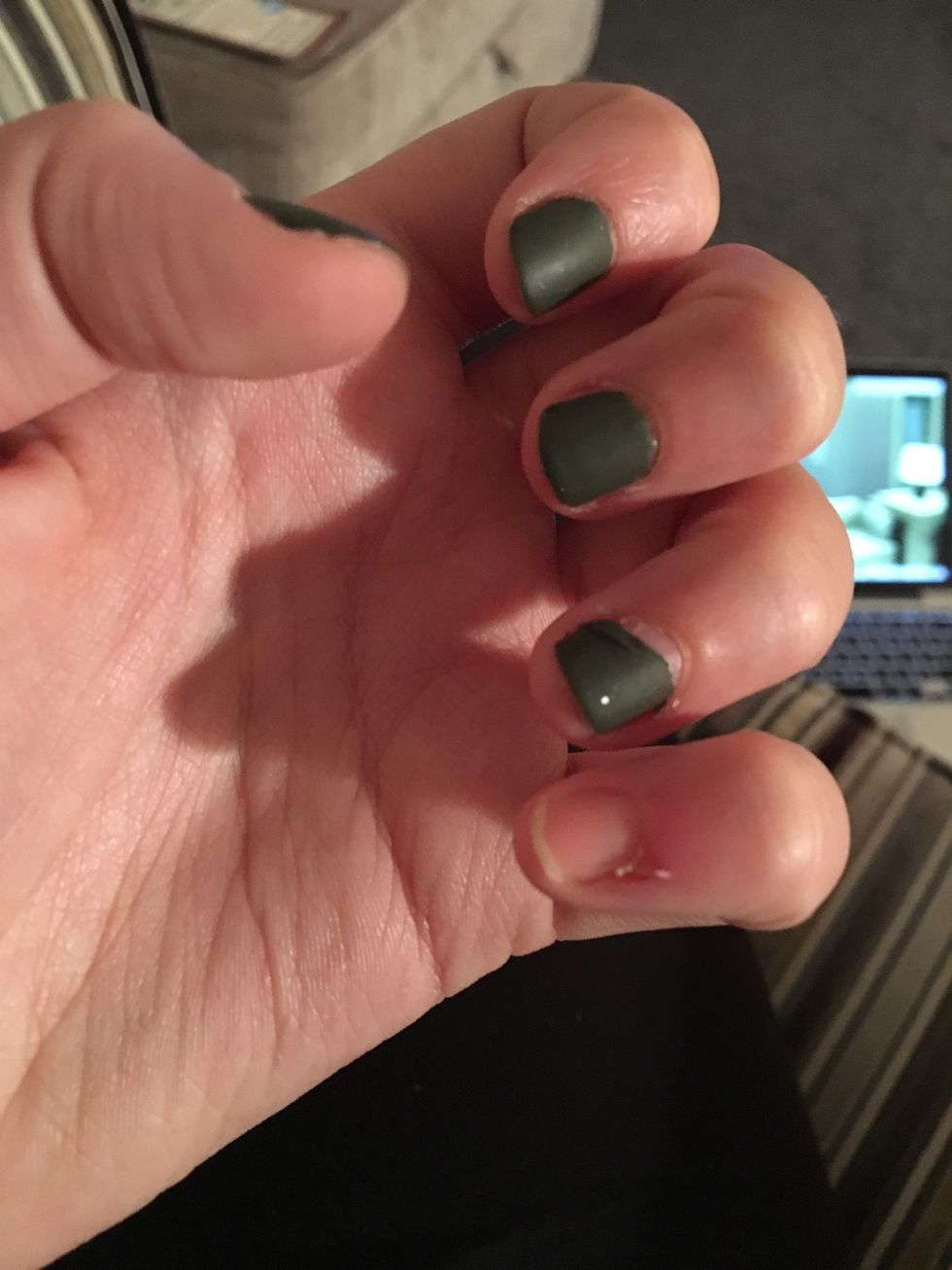 Painted my nails. I've been picking it off though. I bit the cuticle around my little finger and have had it in a plaster for the last few days. Don't do that! It is annoying and hurts.