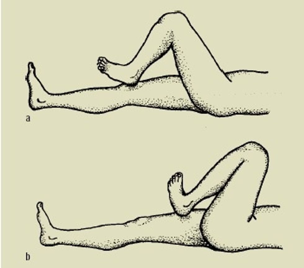 Pedirle al paciente colocar tal\u00f3n sobre su rodilla y lo baje por tibia hasta dedo gord. Observar suavidad, precisi\u00f3n. Con los ojos cerrados se mide sentido postural.