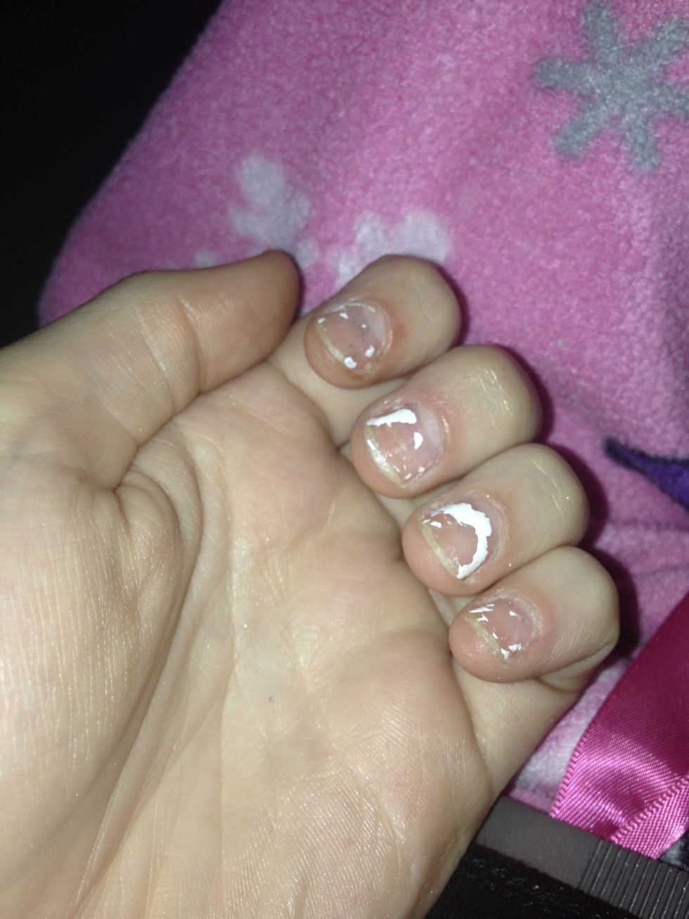 Peels off the polish so we could see :)) look at the progress!!!