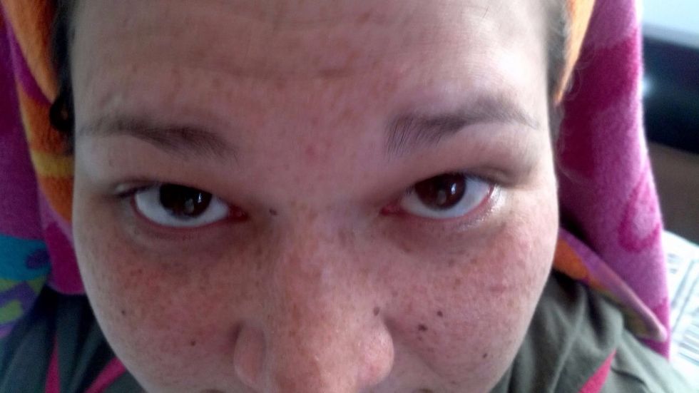 Please don't mind all my freckles!!