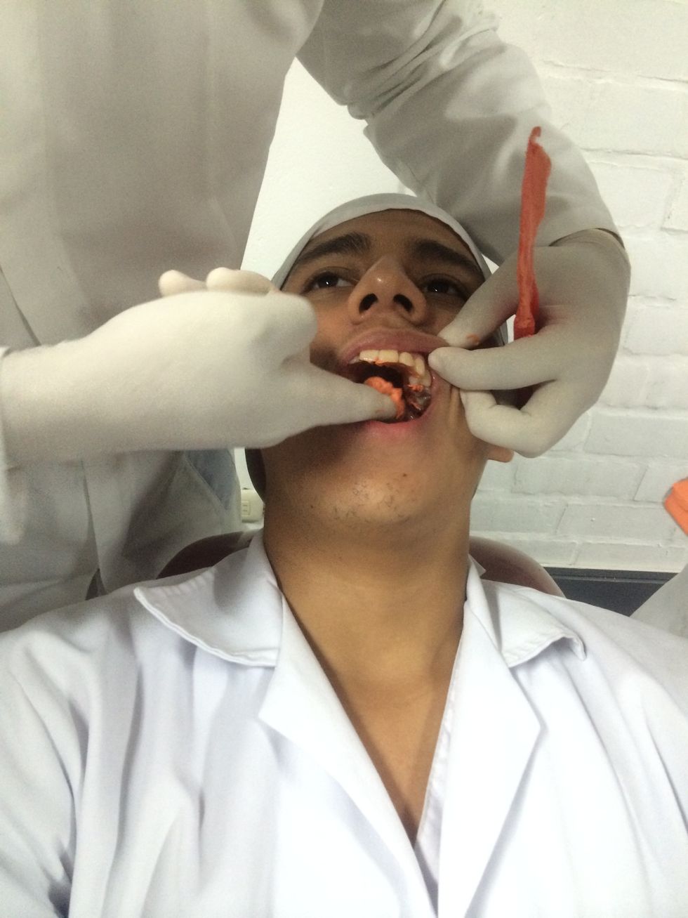 Puede colocar alginato en el paladar y en la zonas gingivales u oclusales, utilizando su dedo con firmeza para evitar burbujas y registrar detalles