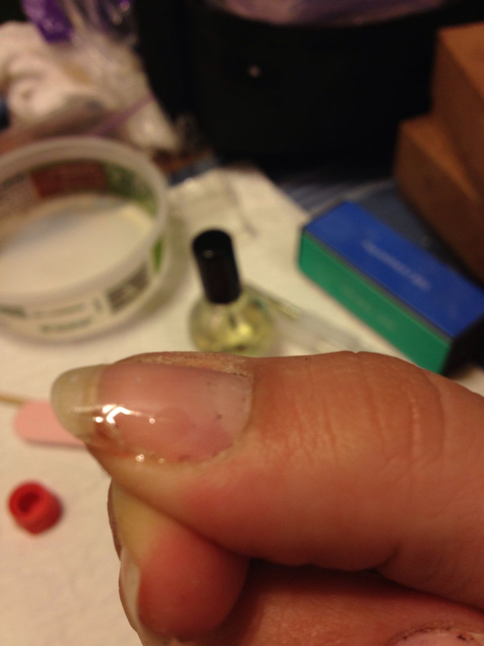 Put nail glue on top of the crack. I am using superglue because dumb dumb me ran out of nail glue. It works the same.