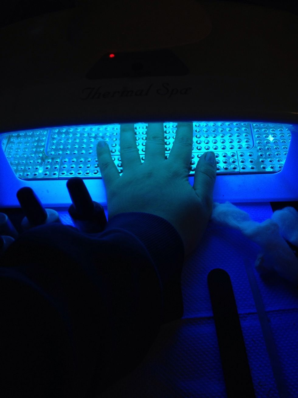 Put under UV light for two minutes. It may feel warm under the light but does not hurt.