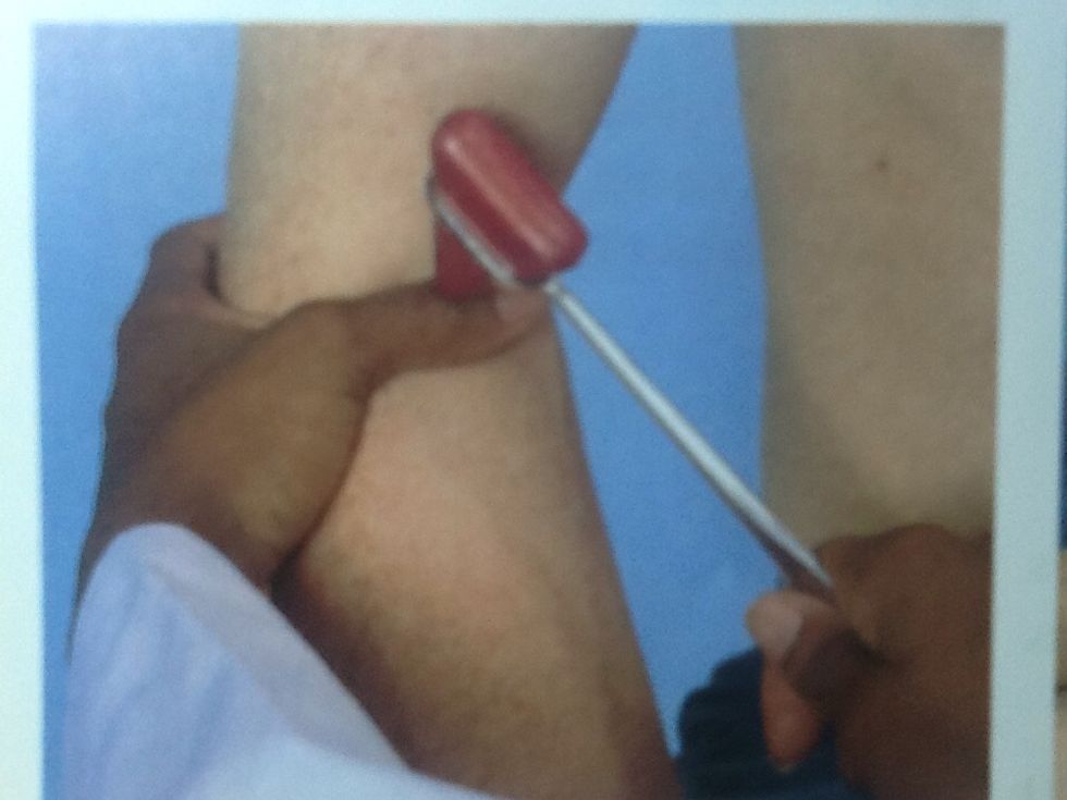 Reflejo bicipital c5 y c6   Flexionar el codo , con la palma de la mano hacia abajo, el dedo pulgar p\u00f3ngalo sobre el tend\u00f3n . Golpee con el martilleen su dedo sobre el tend\u00f3n bicipital