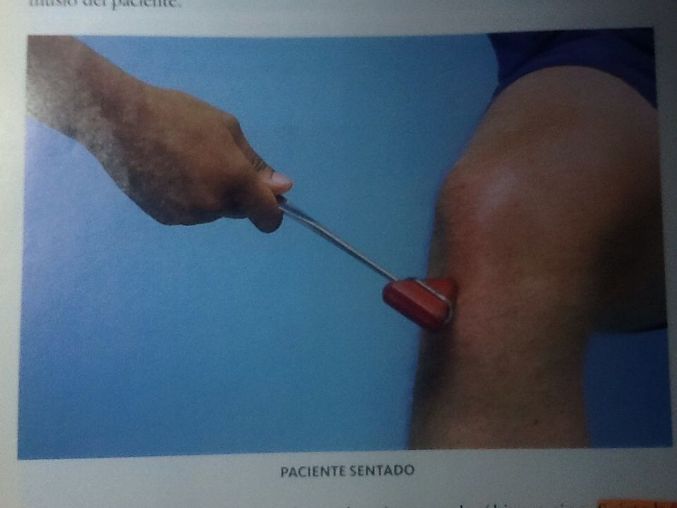 Reflejo rotuliano paciente sentado flexi\u00f3n ando las rodillas, percuta en el tend\u00f3n rotuliano por debajo  de la r\u00f3tula. Observe la contracci\u00f3n del cuadriceps con extensi\u00f3n en la rodilla