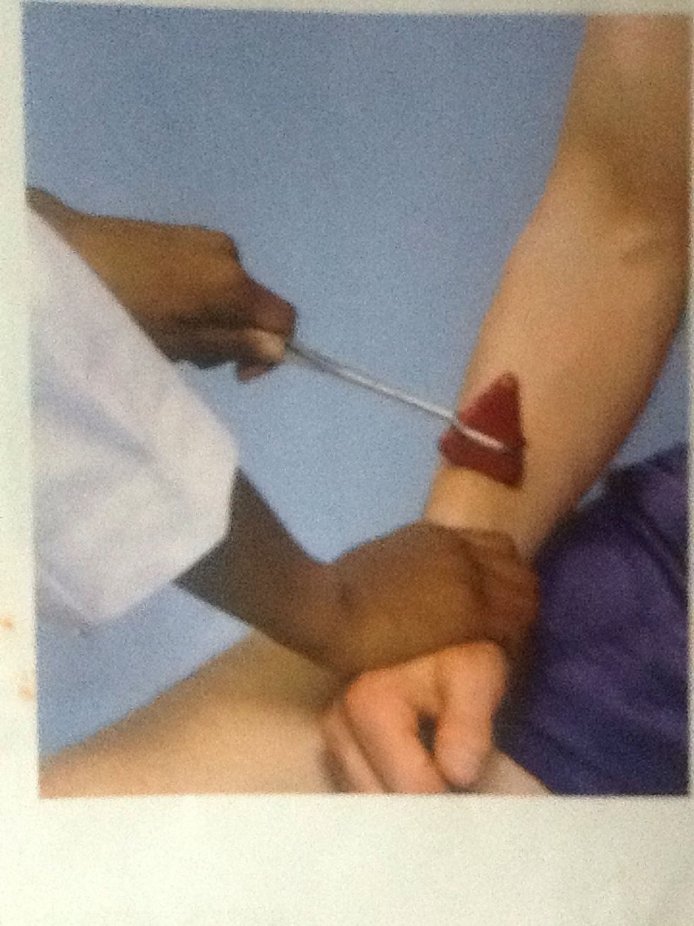 Reflejo supinador   Paciente debe tener la mano apoyada sobre el abdomen, golpee el radio con la parte plana del martillo. Vigile la flexi\u00f3n y supinaci\u00f3n del antebrazo