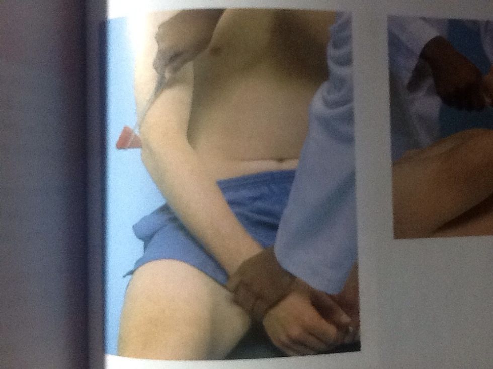 Reflejo tricipital c5 y c6  Paciente sentado. Flexione el codo y atraigalo hacia el t\u00f3rax. Golpee el tend\u00f3n tricipital por encima del codo, aplique un golpe por detr\u00e1s y explore la contracci\u00f3n