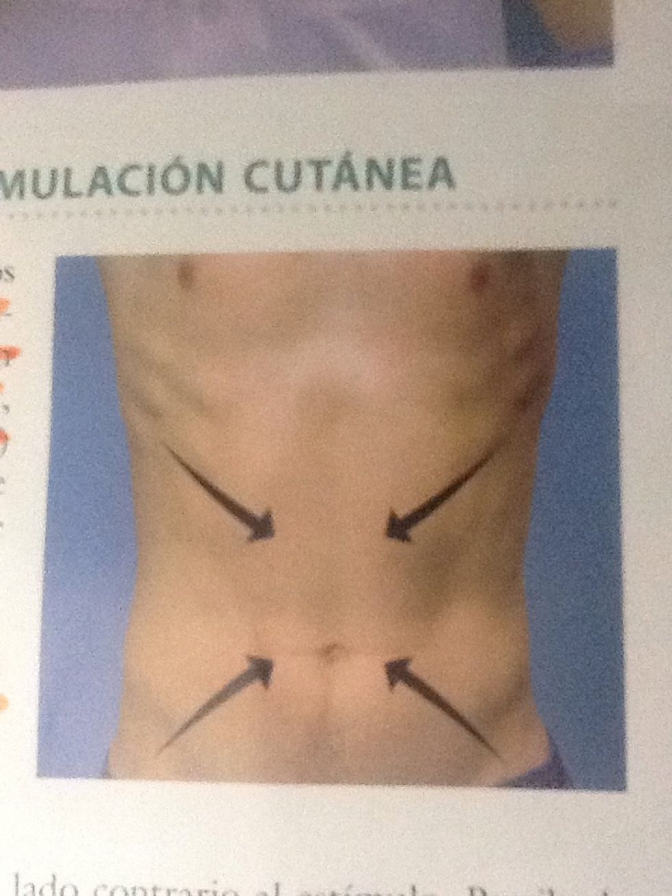 Reflejos abdominales  Golpear suavemente en cada lado del abdomen por encima y por debajo. Observar contracciones abdominales y desviaci\u00f3n del ombligo hacia el est\u00edmulo