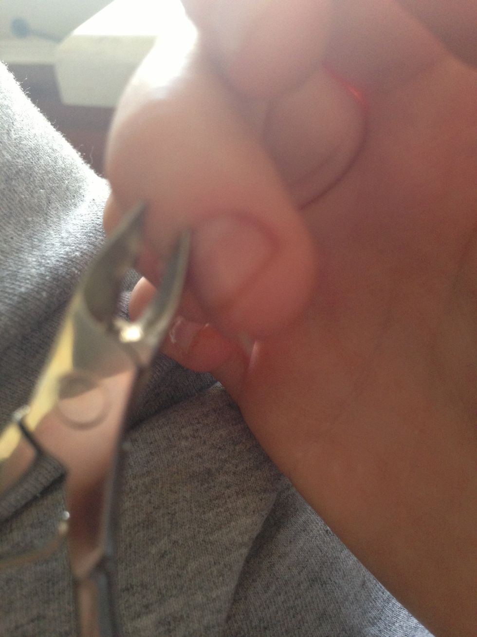 Remember, if it hurts, STOP. That is live skin. Pull the dead skin TOWARDS THE NAIL, or else you will remove live skin, and it will hurt and may even bleed :(