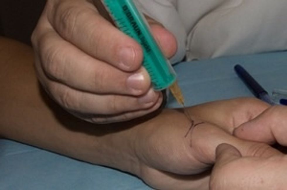 S.DOLOROSA: utilizar punta y pinchar preguntando \u00bfnota alg\u00fan objeto punzante? Aplicar presi\u00f3n m\u00e1s ligera evitando no salida de sangre.