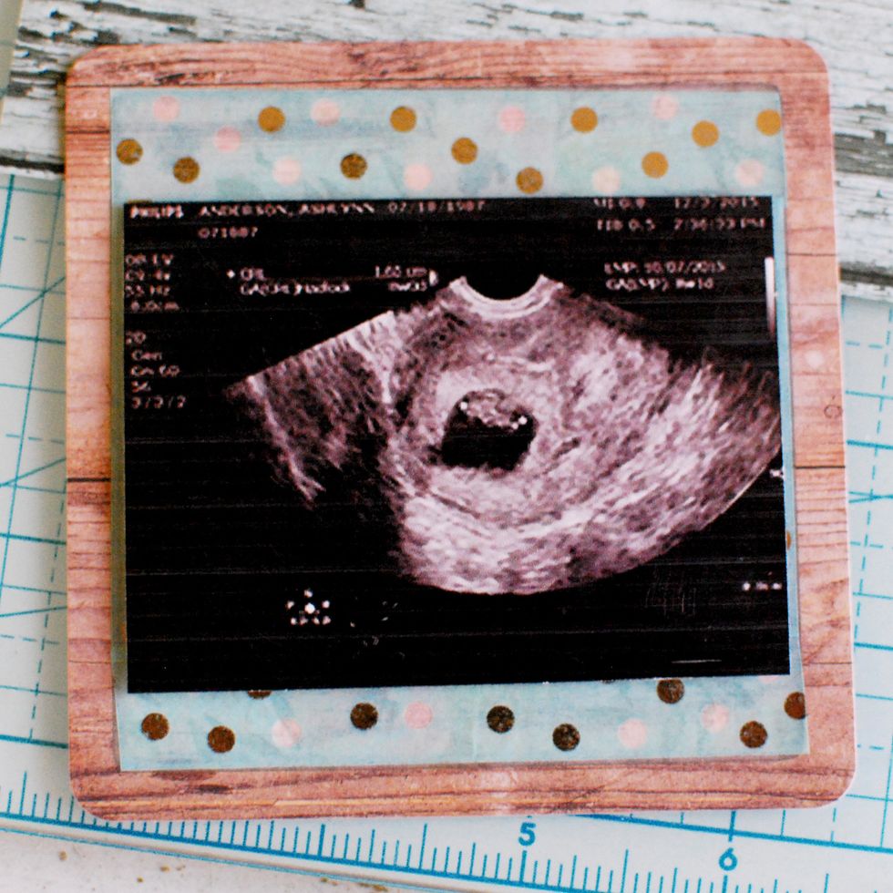 Secure your Ultrasound image to the square with some 3D Dots. Some images will be different size, so make sure to print out a size that will fit inside this Square.