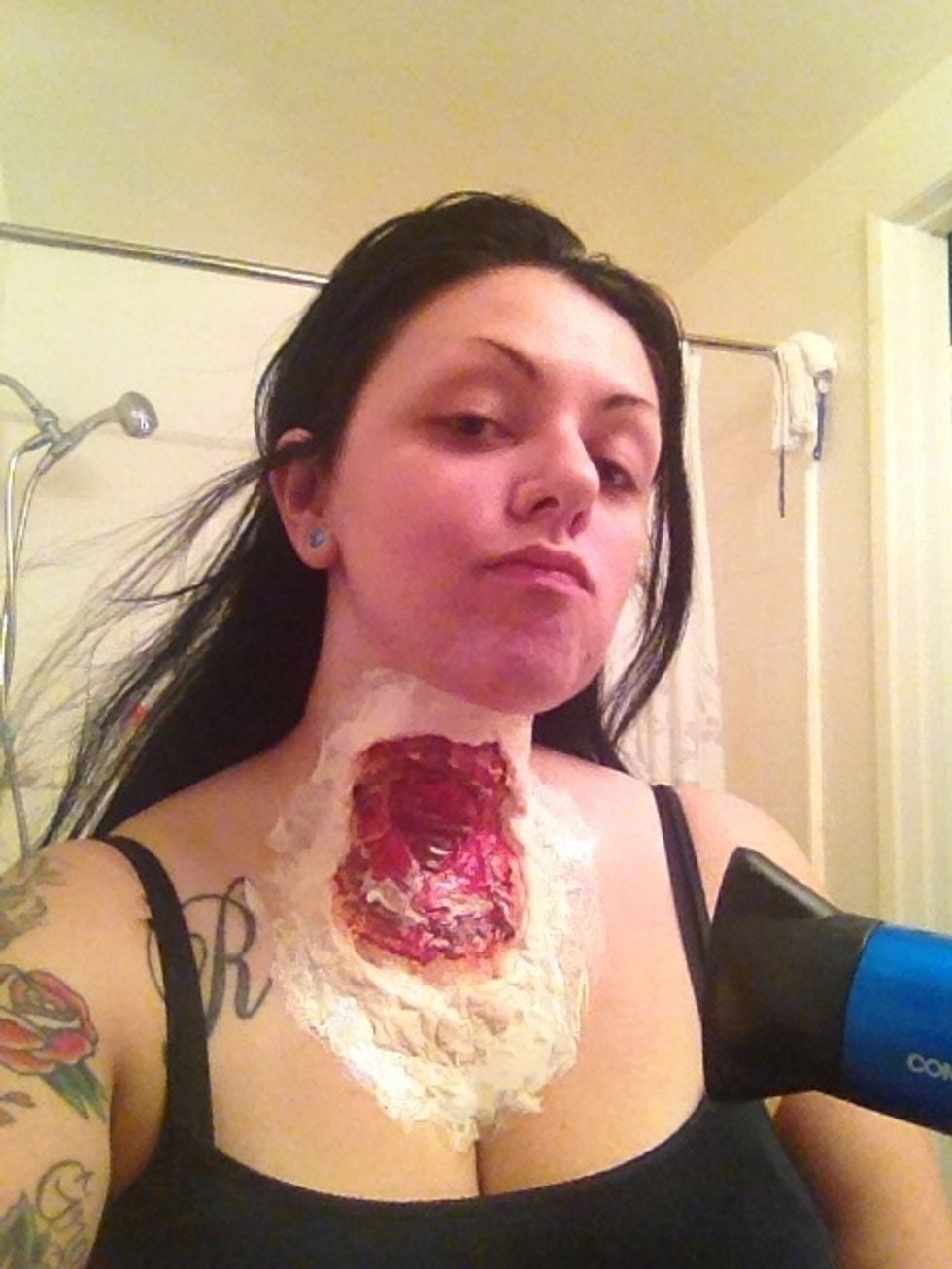 See how far I went out from the prosthetic.