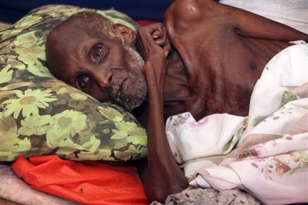 Several issues like hunger, illness and thirst are both causes and effects for instance not having water means you're poor, but being poor also means you can't afford water or food.