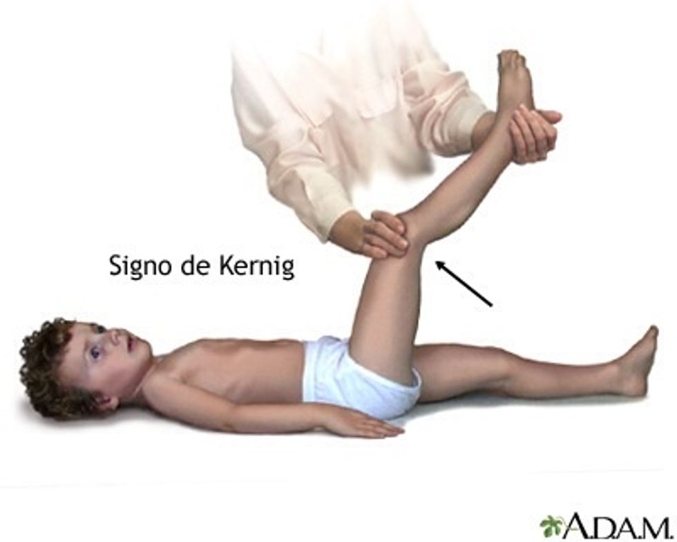 Signo de Kerning  Flexione el miembro inferior y luego enderece la rodilla. Dolor y resistencia a la extensi\u00f3n de rodilla = signo de Kerning positivo --> bilateral, irritaci\u00f3n meningea.