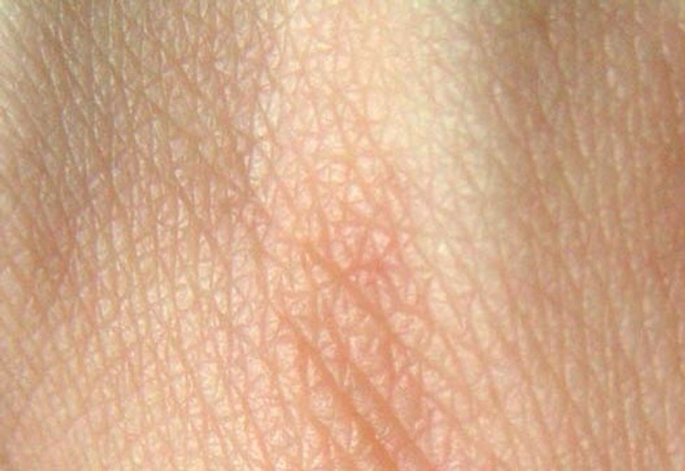 Skin
