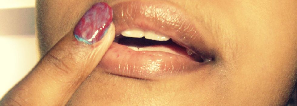 so gently dab vaseline to your mouth... :)