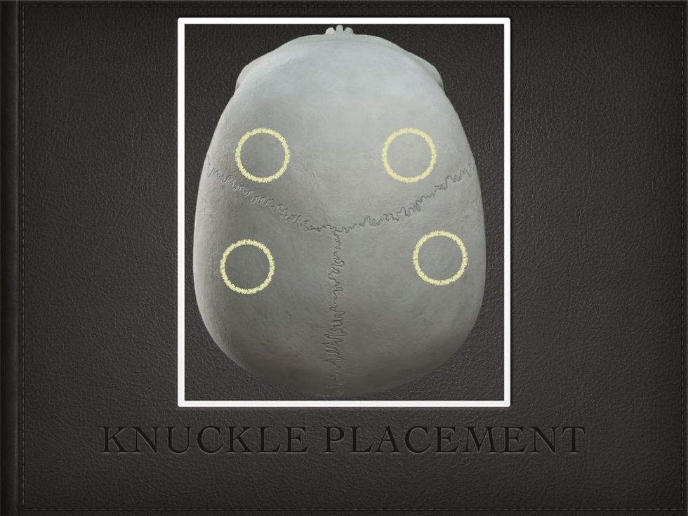 So I took my knuckle and applied firm pressure to these areas on my skull (locations may not be exact). And as long as my knuckle was there, the pain left the areas of my headache.