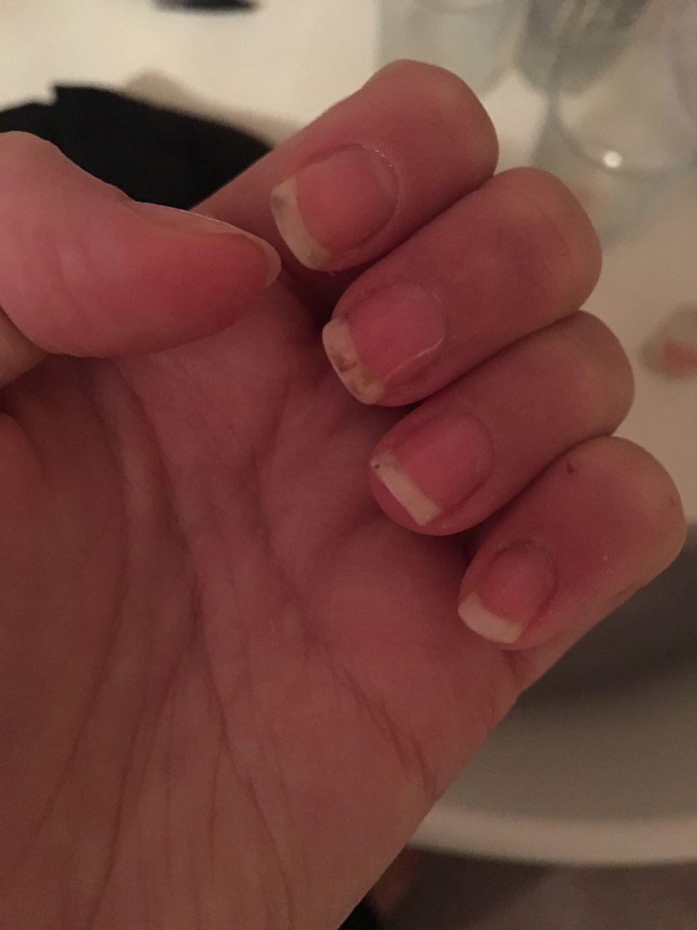 Sorry I haven't posted for a while! Here are my nails now! They're so long and almost back to the length before I bit them. \ud83d\ude0a\ud83d\udc85\ud83c\udffb