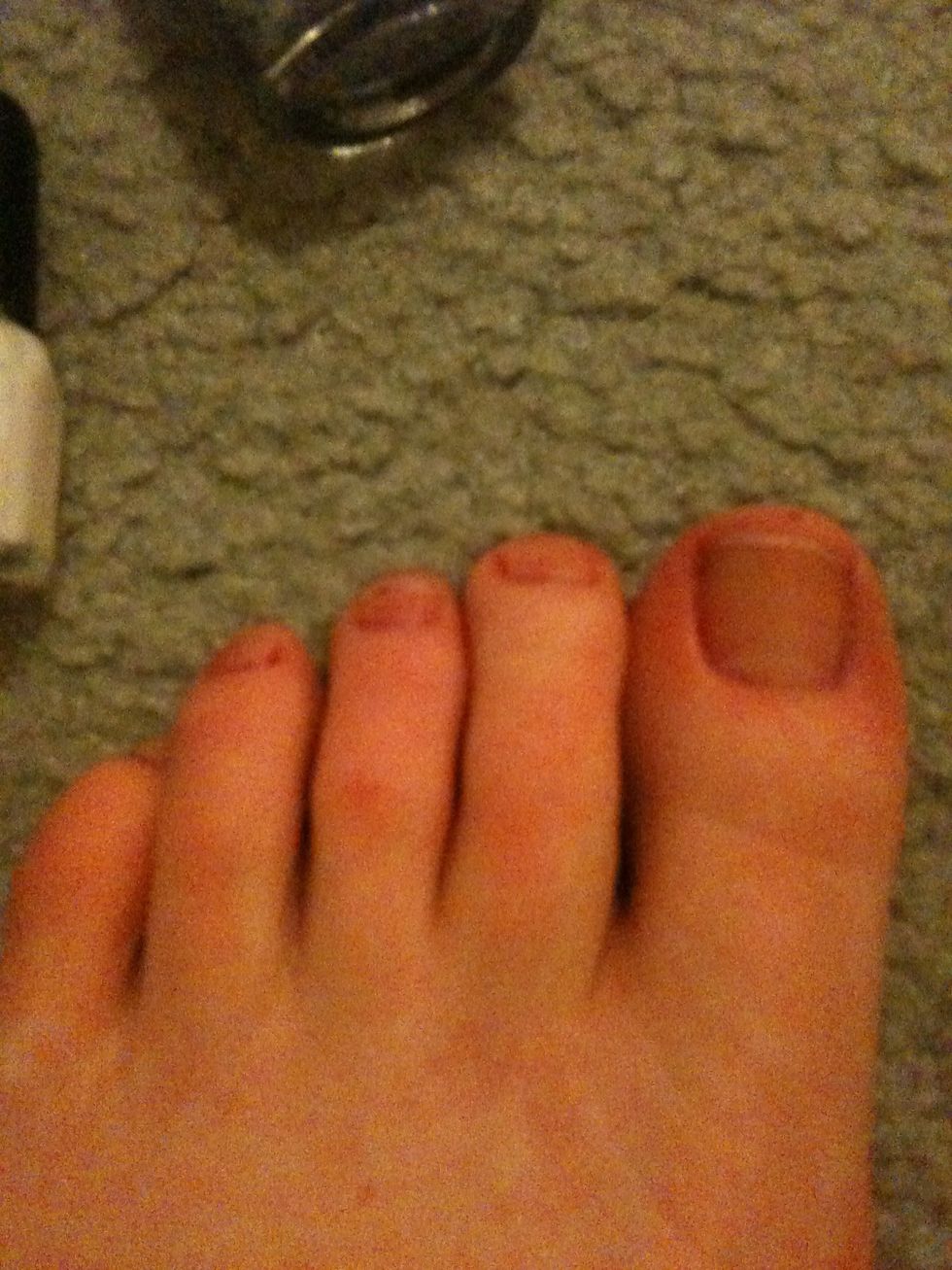 Start with a clean slate (yes my toes are ugly)