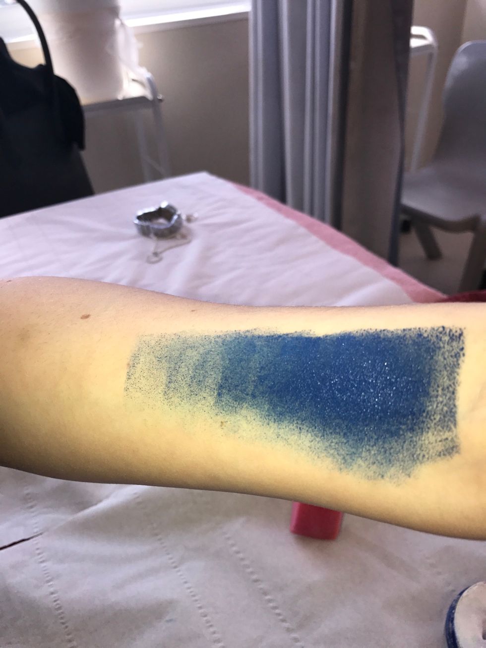 Step 4/put the sponge onto your arm