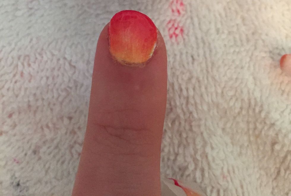 Step 9: Remove tape from nail bed.