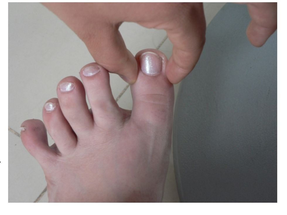 Sujete ambos lados del dedo gordo del pie. P\u00eddale al paciente que cierre los ojos y que indique qu\u00e9 movimiento siente al subirlo o bajarlo. Repita la prueba alternando los dedos.