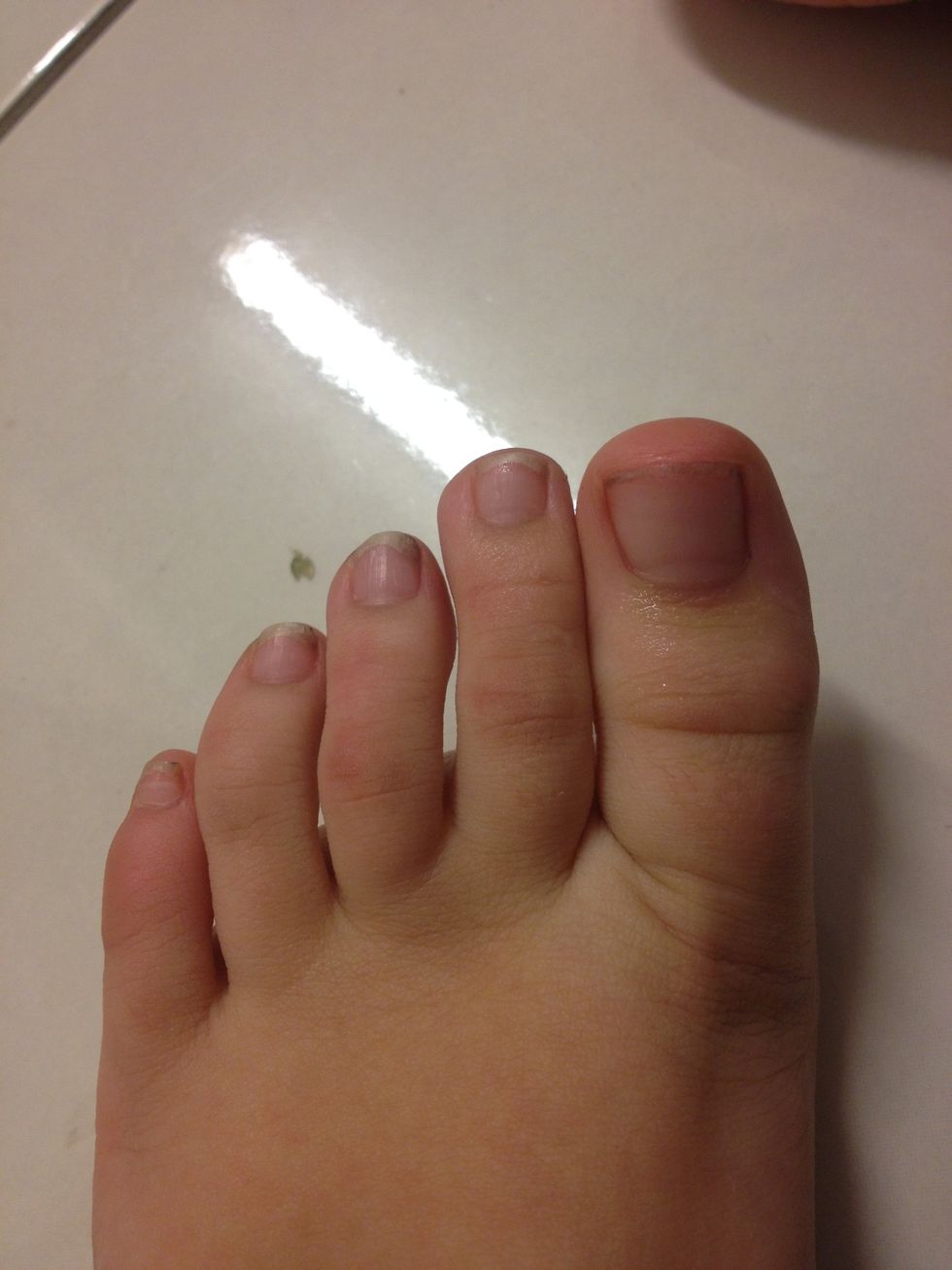 Take off all nail polish.