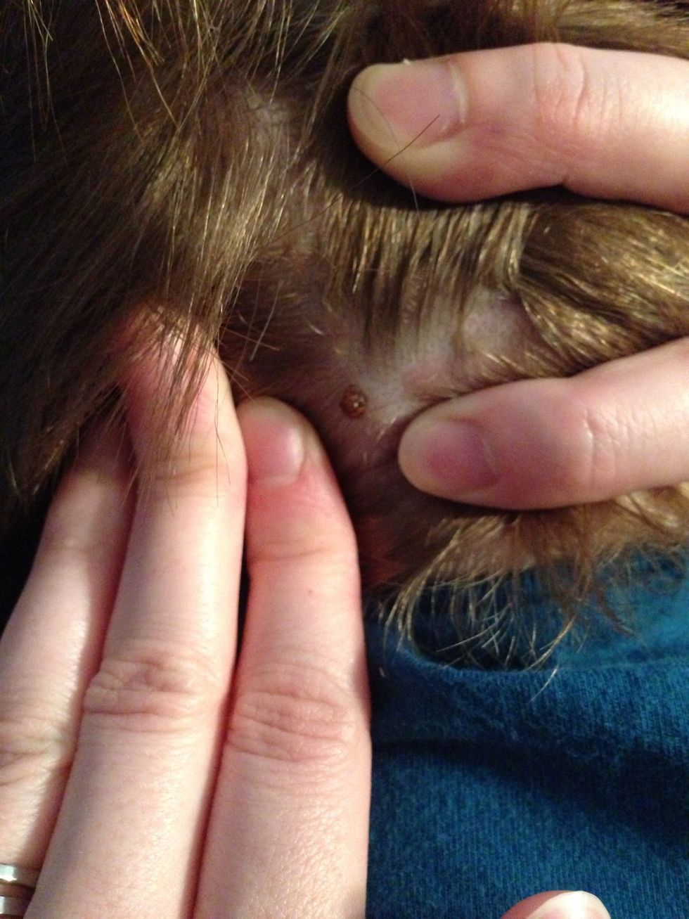 That little bugger was latched in good. We knew there was going to be crying, so we tried the best we could to soothe him throughout the process.