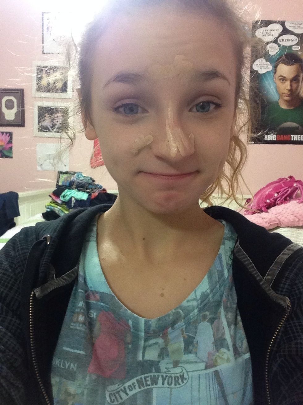 then put liquid concealer on the rest of the places beeded