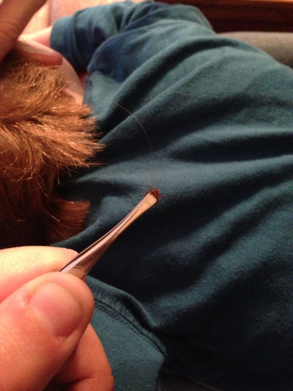 There he is. Make sure you got the head off with the body. Otherwise, you'll need to tweeze again.