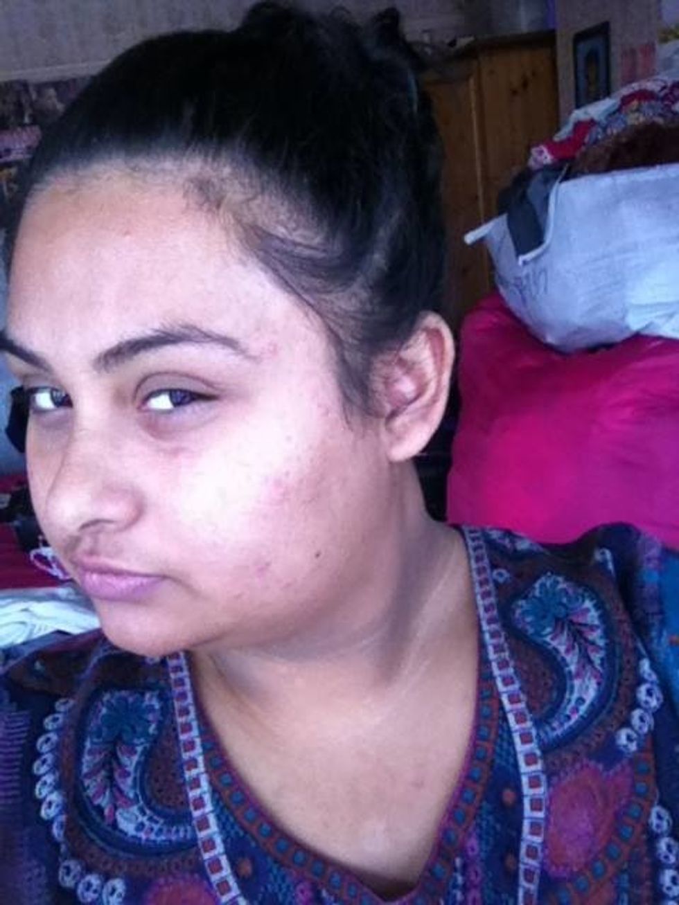 There i have applied my moisturizer and free from any oils and dead skin, as you can see i have acne and pimples (see other post ) and they look horrific ,so i need a good cover up foundation :)