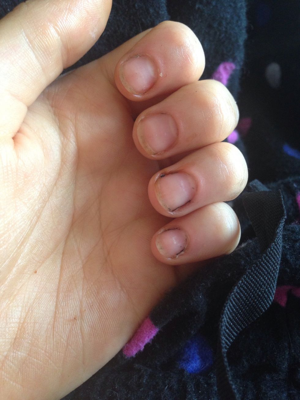 THESE DONT EVEN LOOK LIKE MY NAILS ANYMORE:O keep it up guys!!!!
